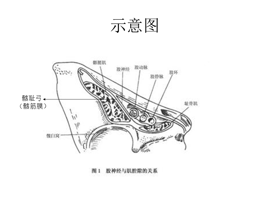 超声引导股神经阻滞课件文档资料.ppt_第2页