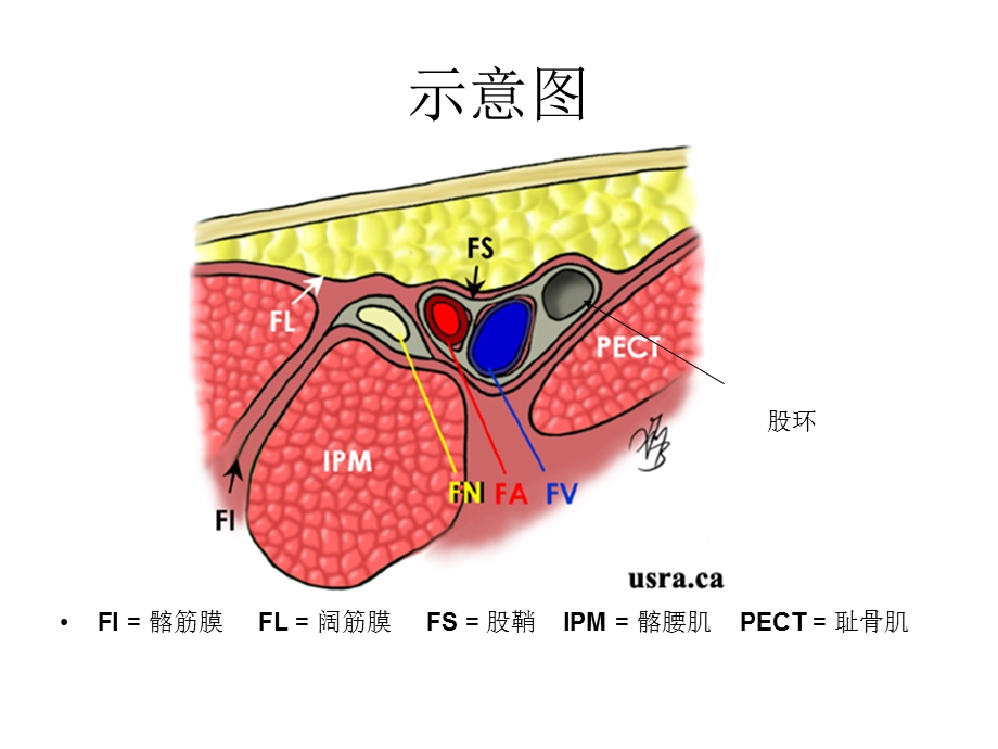 超声引导股神经阻滞课件文档资料.ppt_第3页