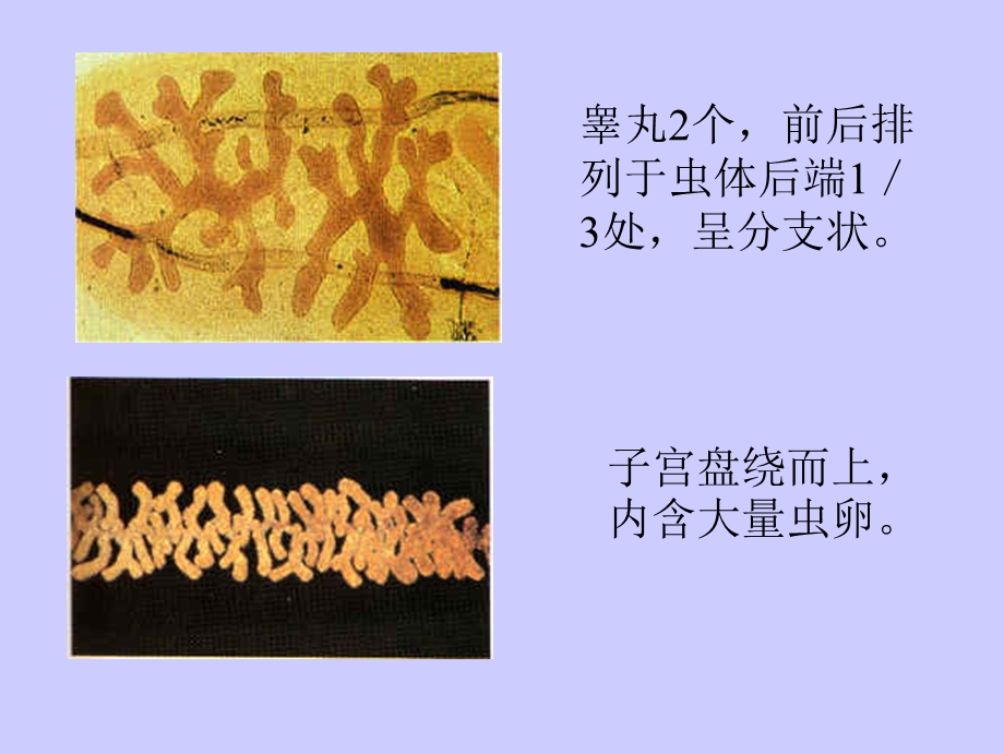 人体寄生虫实验肝和胆管寄生虫精选文档.ppt_第3页