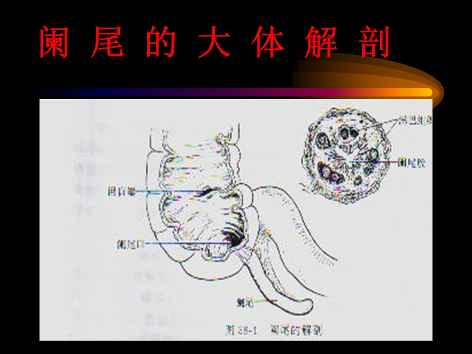 13阑尾炎、腹部教学幻灯PPT课件.ppt_第1页