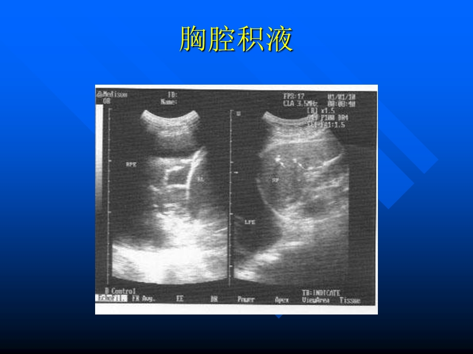 介入、腹膜后超声诊断文档资料.ppt_第1页