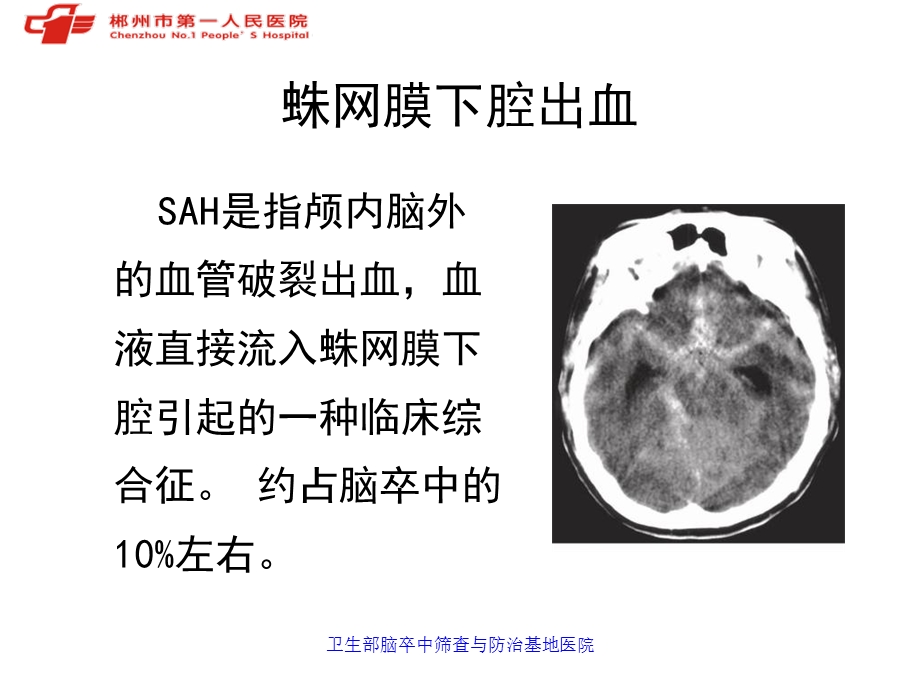 动脉瘤性蛛网膜下腔出血诊治PPT文档.ppt_第2页