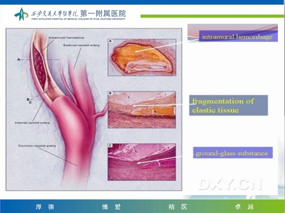 神经外科讲课会议讲课文档资料.ppt_第1页