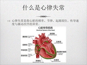 儿童常见心律失常的诊治ppt课件PPT文档.ppt