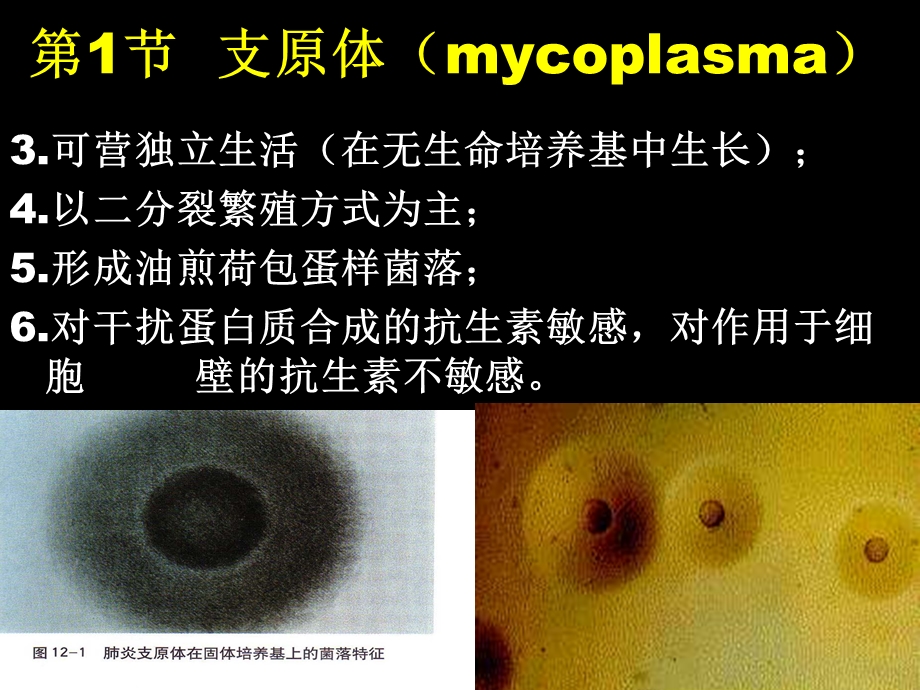 医疗：5.其他原核细胞型m.文档资料.ppt_第2页