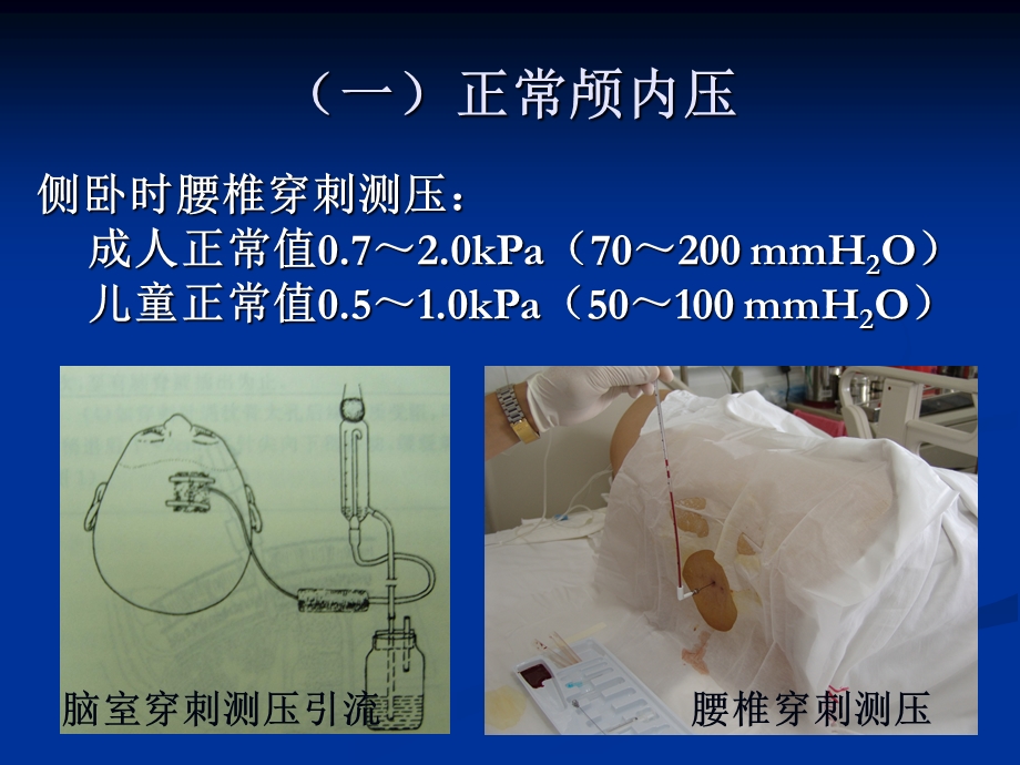 唐贝颅内压增高病人的护理ppt课件PPT文档.ppt_第2页