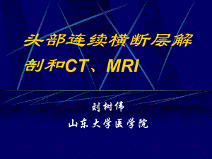 头部连续横断层解剖及CT、MRI名师编辑PPT课件.ppt