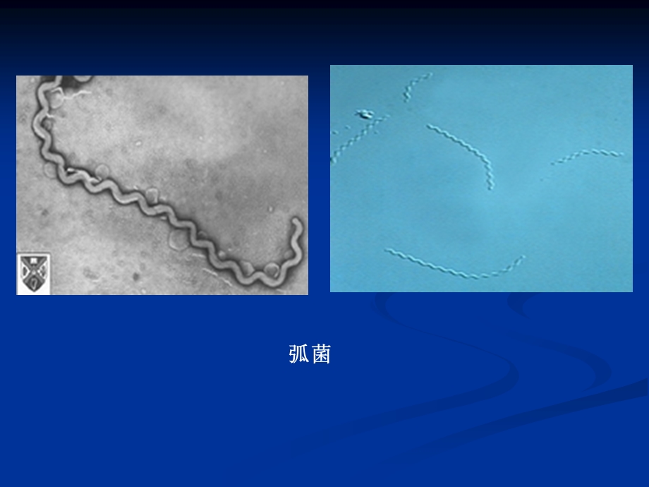 微生物实验二细菌的简单染色和革兰氏染色文档资料.ppt_第2页