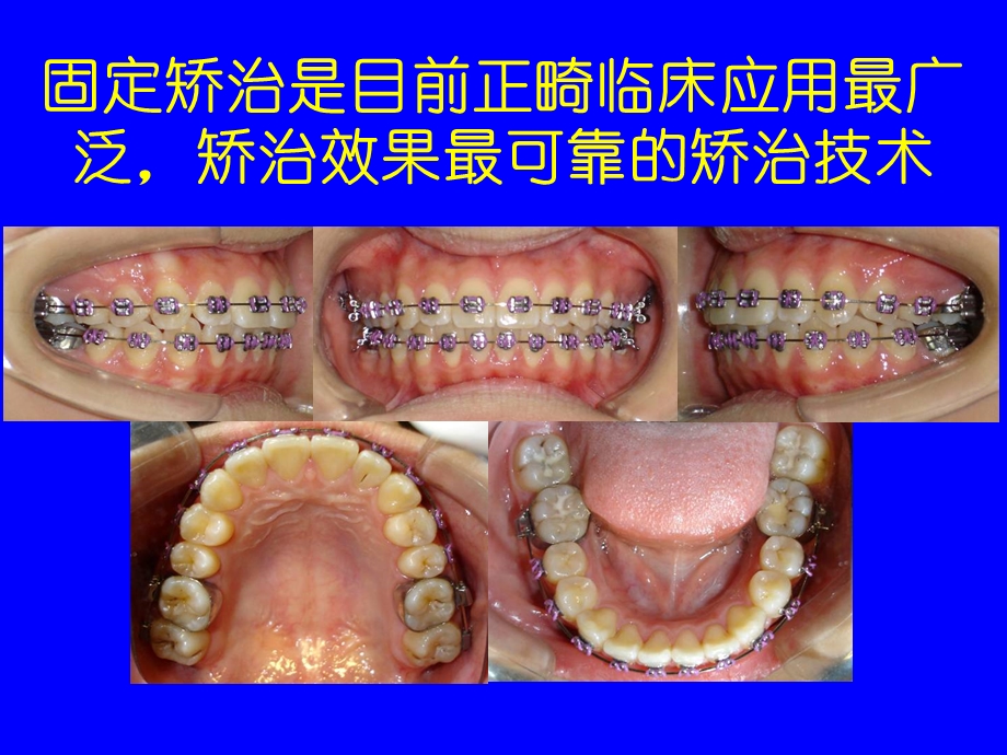 口腔正畸基础学文档资料.ppt_第1页