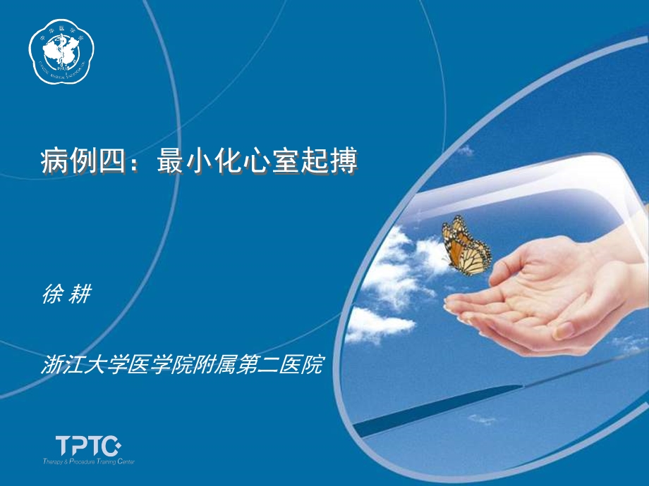 病例四最小化心室起搏名师编辑PPT课件.ppt_第1页