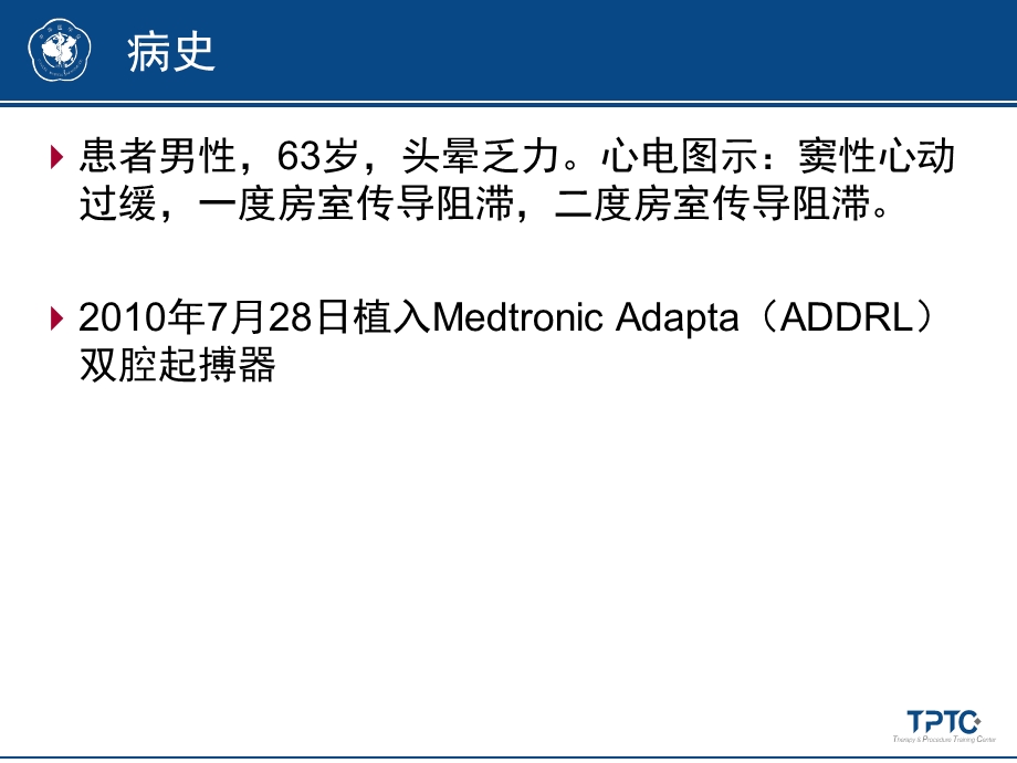 病例四最小化心室起搏名师编辑PPT课件.ppt_第2页