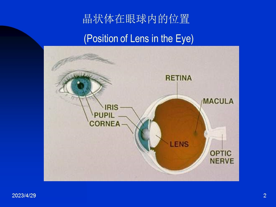 白内障病人护理NursingforCataractPatients名师编辑PPT课件.ppt_第2页