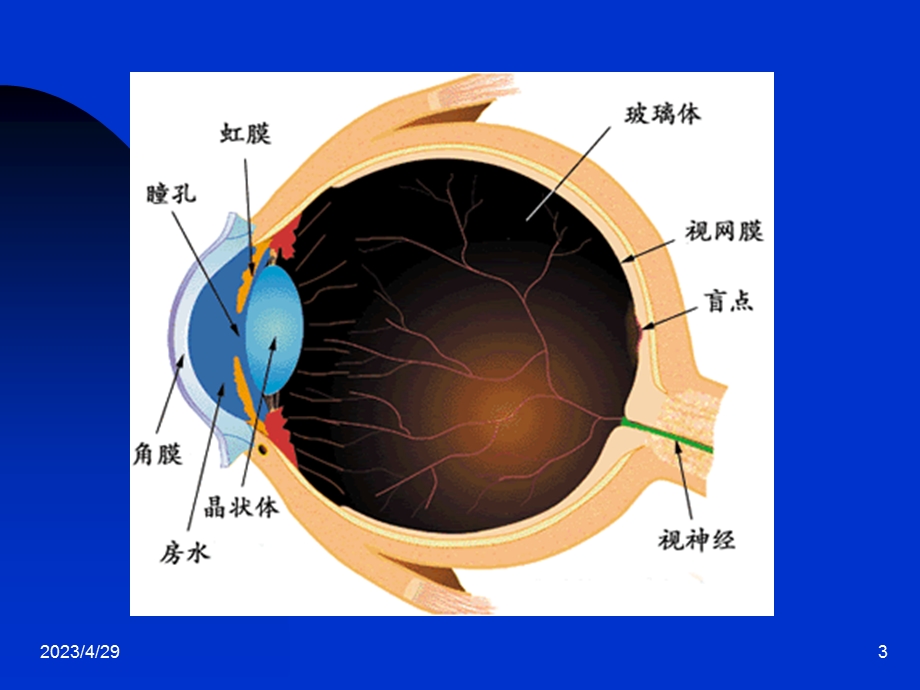 白内障病人护理NursingforCataractPatients名师编辑PPT课件.ppt_第3页