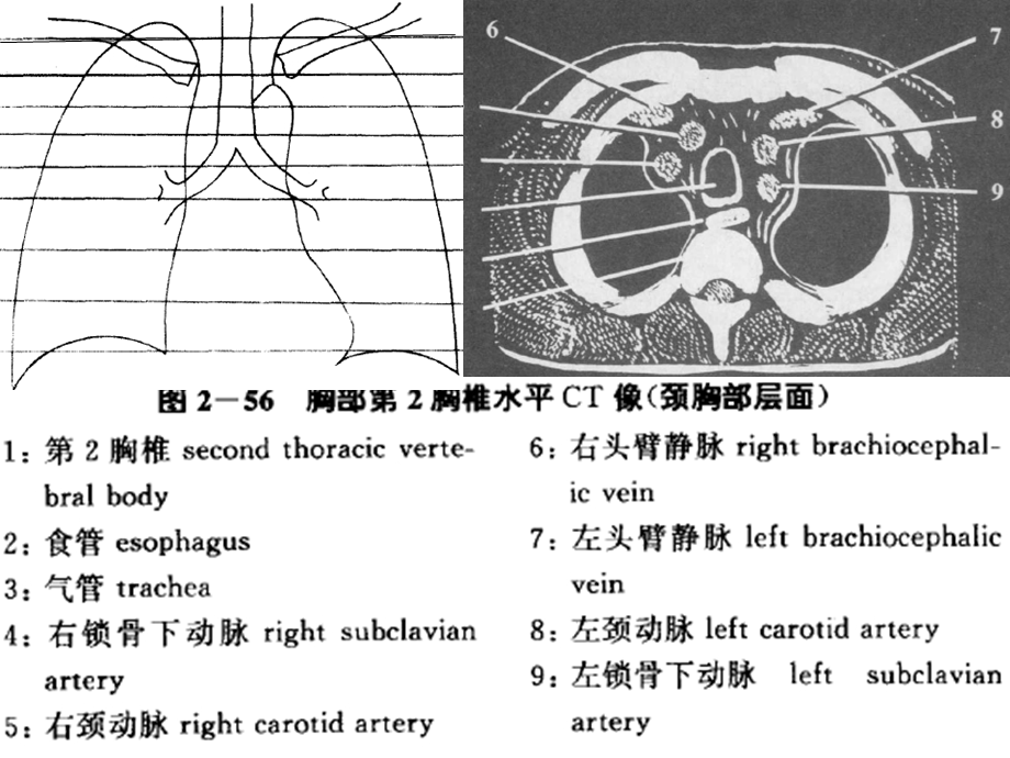 心血管系统CT读片手册名师编辑PPT课件.ppt_第2页