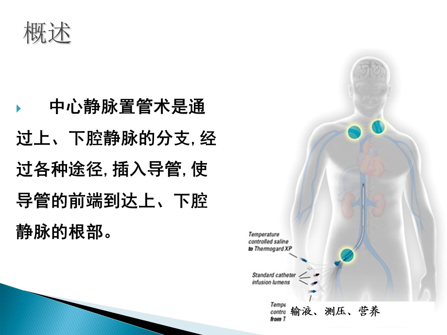 中心静脉置管护理116文档资料.ppt_第3页