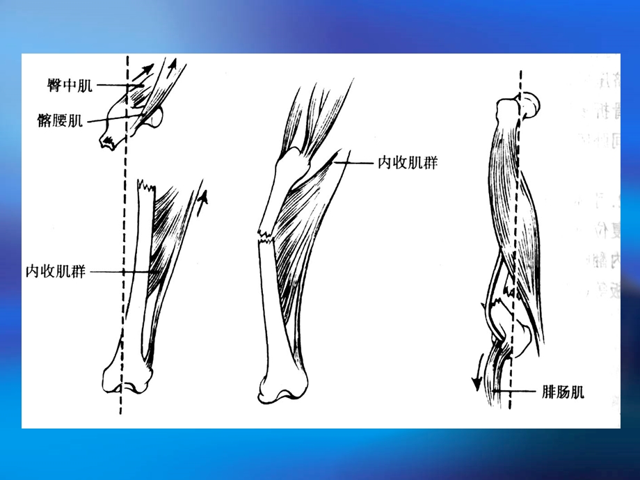 下肢脊柱骨折PPT文档.ppt_第2页