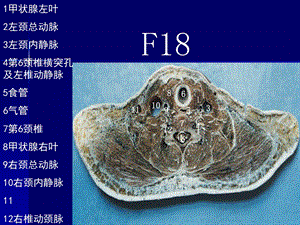 断面解剖学课件胸部断层精选文档.ppt