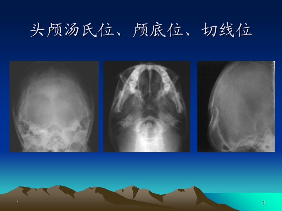 中枢神经系统疾病ppt课件文档资料.ppt_第3页