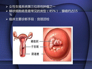 宫颈癌靶区勾画PPT文档.pptx