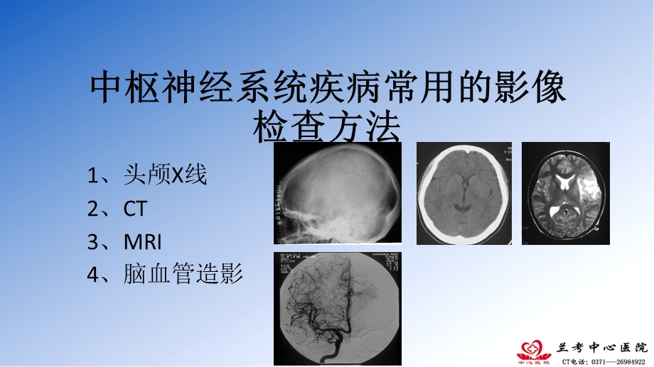 中枢神经系统影像诊断思路颅脑基础ppt课件文档资料.pptx_第2页