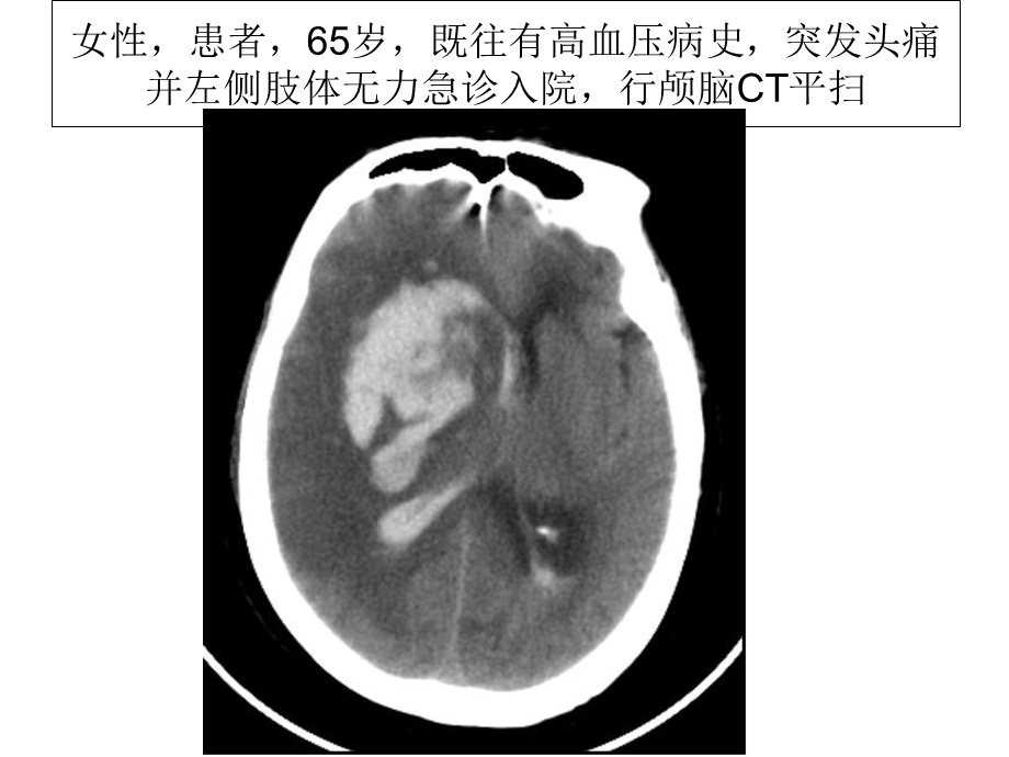 临床医师考试(放射学,答案)PPT文档.ppt_第1页