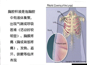 呼吸内科教学查房胸腔积液文档资料.ppt