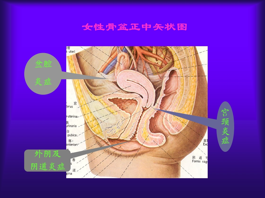 女性生殖系统炎症94文档资料.ppt_第1页