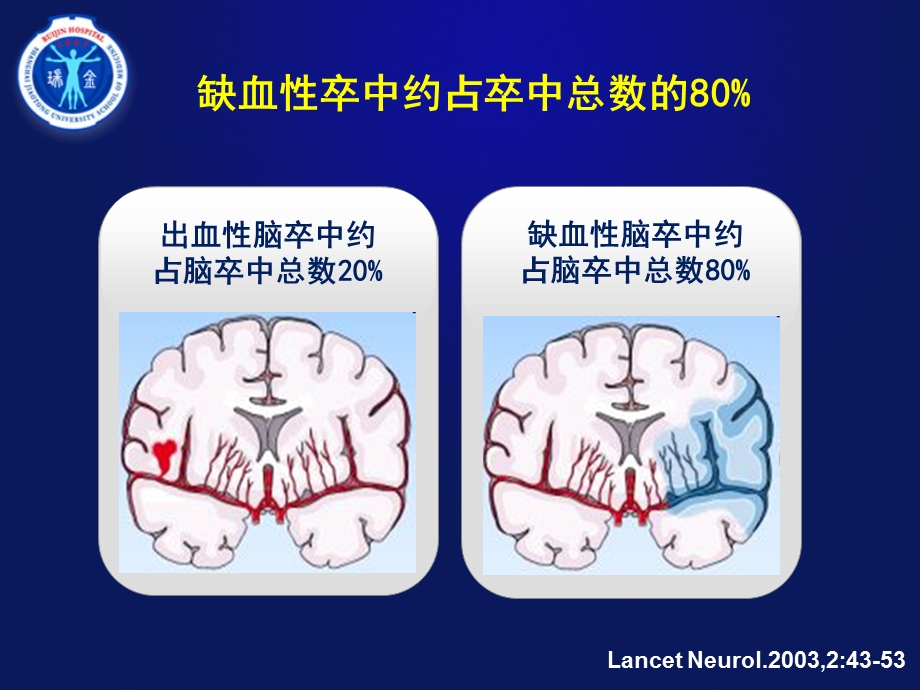 TXL脑血管精选文档.ppt_第3页