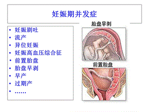 妊娠合并症、并发症处理PPT文档.ppt