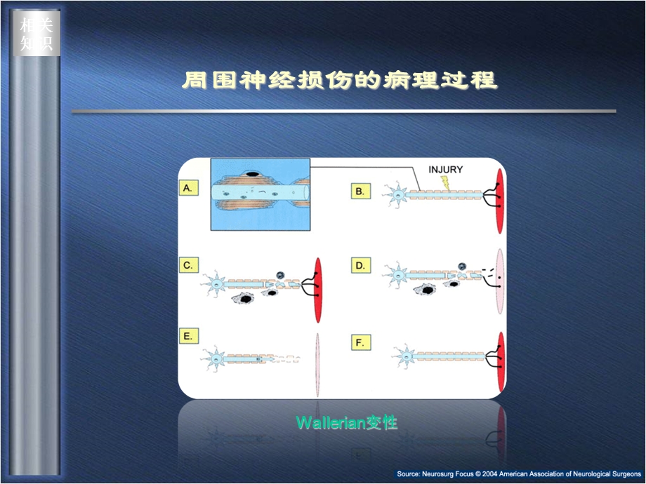 周围神经损伤的药物治疗ppt课件精选文档.ppt_第3页