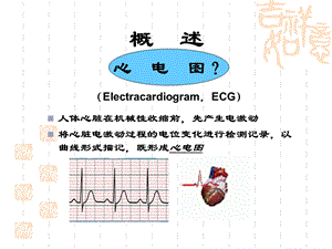 心电13级五年制心电图文档资料.ppt