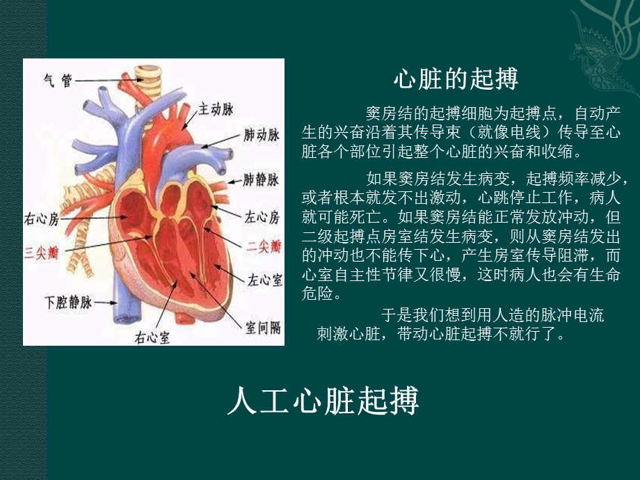 心脏起搏器名师编辑PPT课件.ppt_第2页