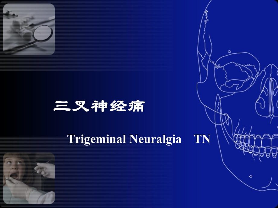 口腔颌面神经疾患文档资料.ppt_第1页