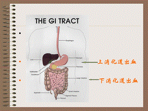 上消道大量出血精选文档.ppt