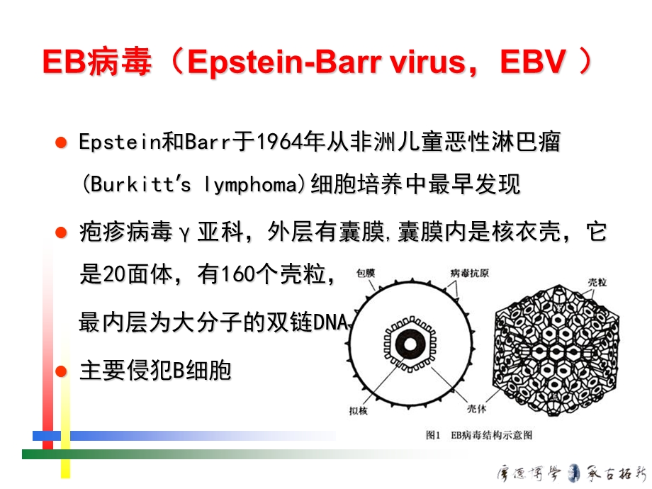 最新eb病毒感染的特殊表现PPT文档.ppt_第1页