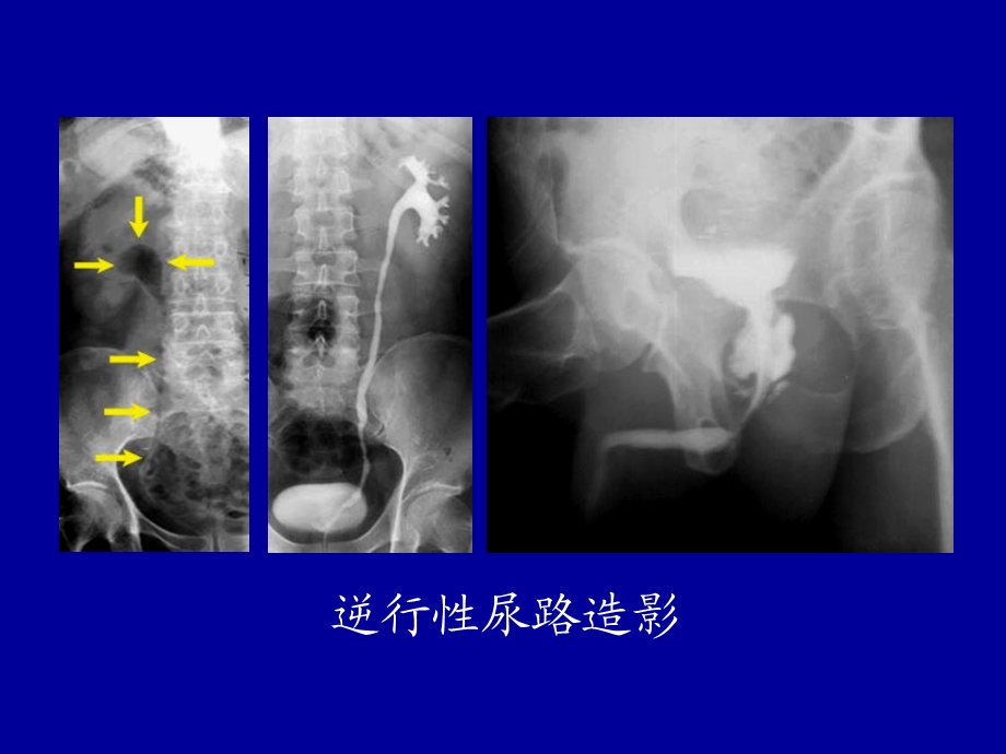 最新【医药健康】医学影像学 — 泌尿系统PPT文档.ppt_第3页