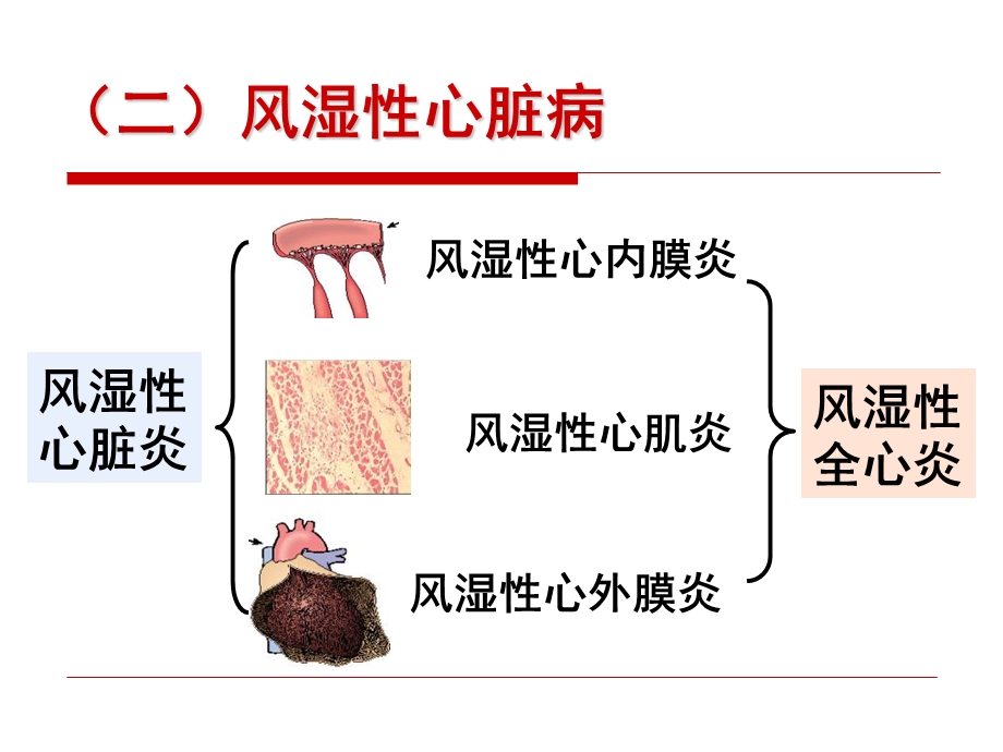 风湿病经典文档资料.ppt_第1页