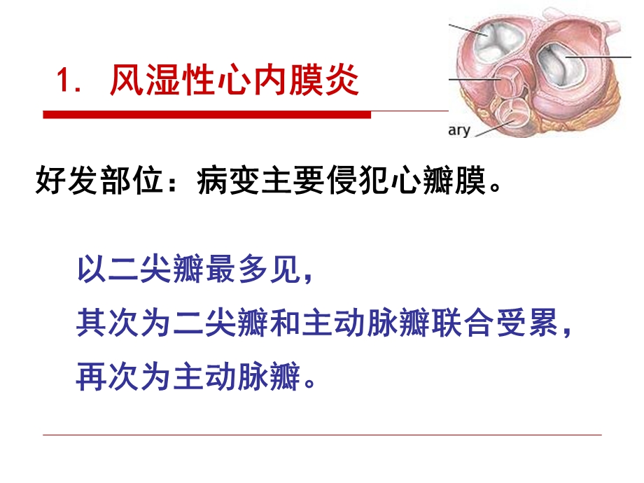 风湿病经典文档资料.ppt_第2页