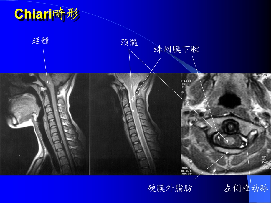 MRI图像脑01名师编辑PPT课件.ppt_第1页