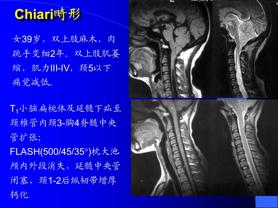 MRI图像脑01名师编辑PPT课件.ppt_第2页