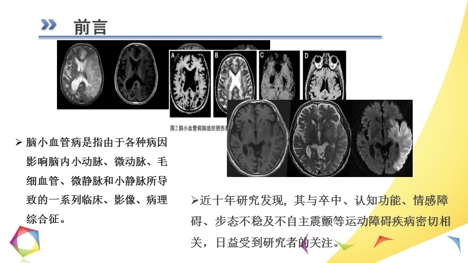 最新脑小血管病PPT文档.pptx_第1页