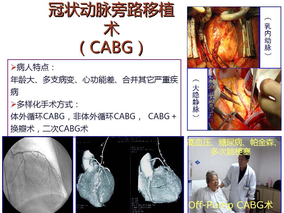 心脏搭桥手术图片PPT文档.ppt_第1页