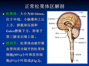 最新松果体区肿瘤PPT文档.ppt