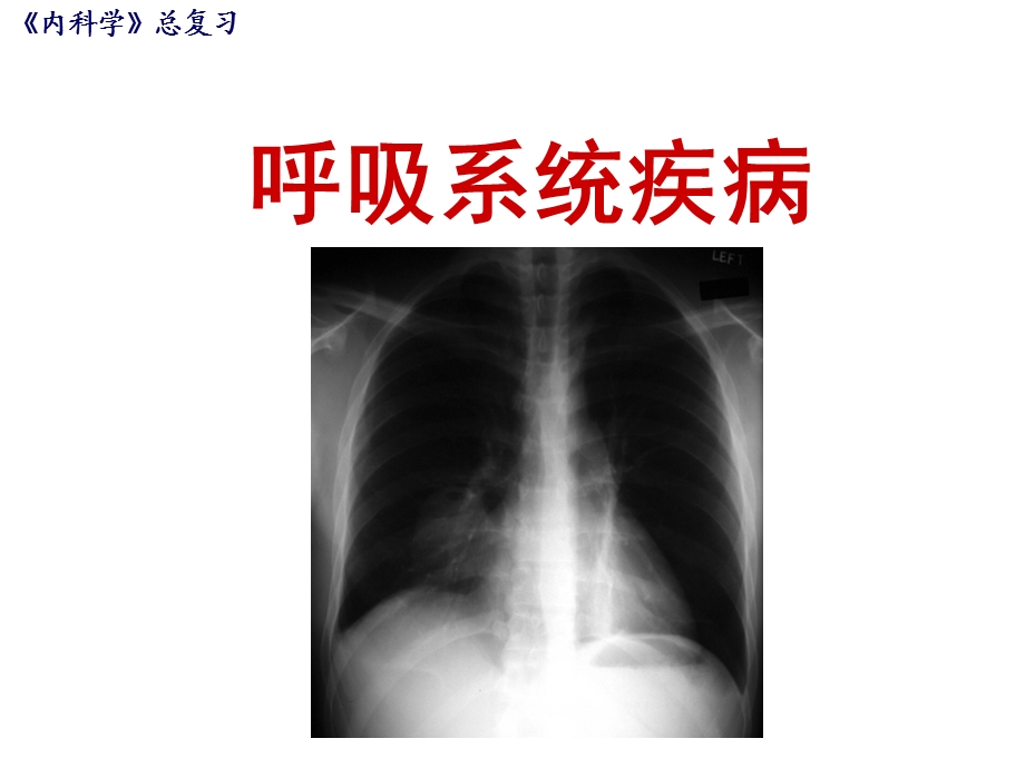 内科学总复习PPT文档.ppt_第3页