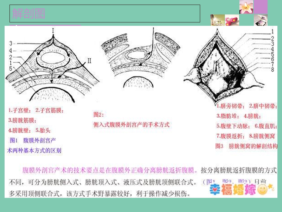 剖宫产切口愈合不良的护理文档资料.ppt_第2页