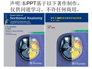 头颈CTMRI解剖图解系列1名师编辑PPT课件.ppt