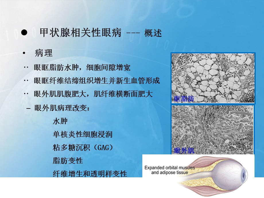 甲状腺相关性眼病影像学表现.pptx_第3页