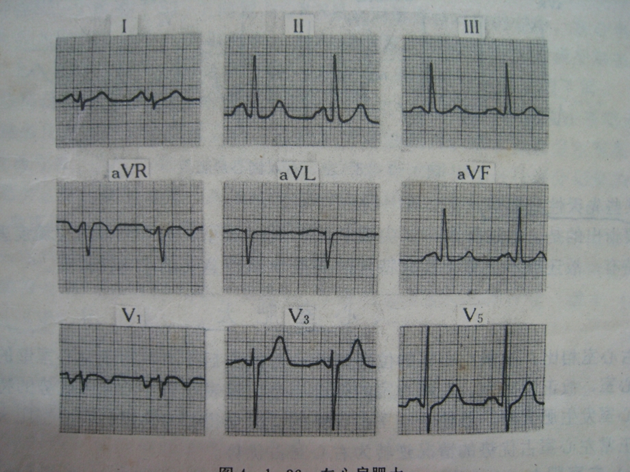 最新看图识心电图PPT文档.ppt_第2页