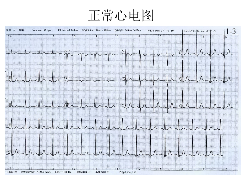 最新看图识心电图PPT文档.ppt_第3页