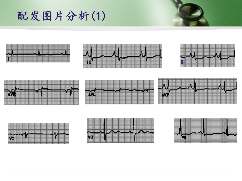 实用心电图解析ppt课件文档资料.ppt_第1页